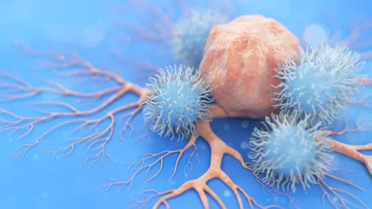 Liminar para Avelumabe (Bavencio): O Guia Jurídico para Garantir a Terapia de Manutenção sem Atrasos