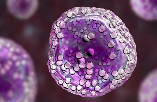 Como conseguir o Avelumabe (Bavencio) pelo SUS: Guia Jurídico para Imunoterapia de Alto Custo