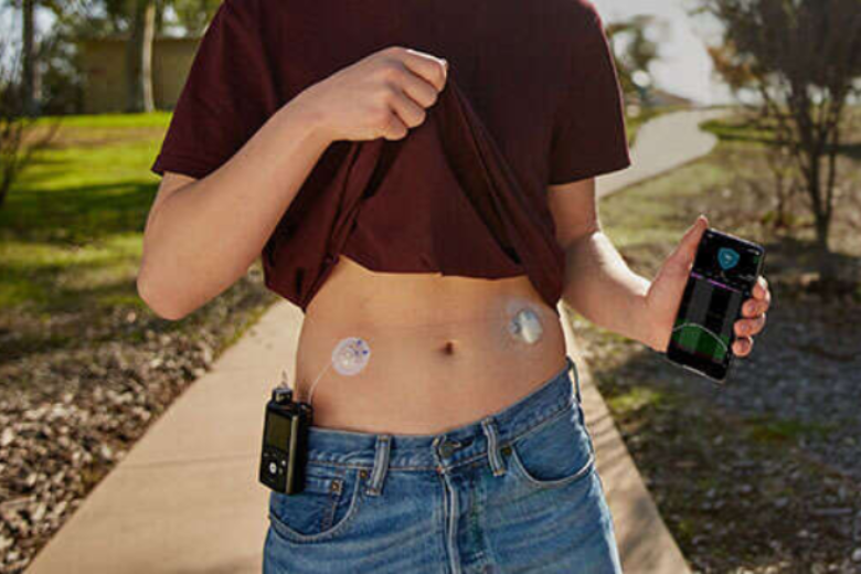 Liminar para bomba de insulina: O guia definitivo para obter o tratamento imediato em 2026