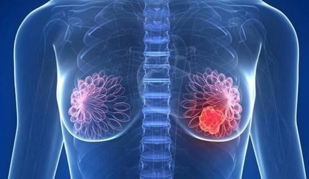 palbociclibe
