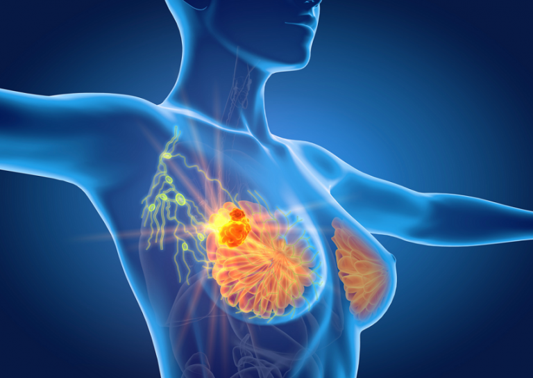 herceptin
