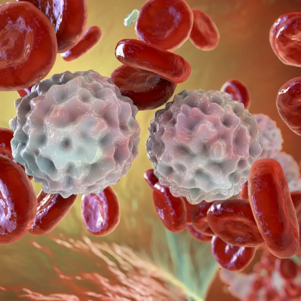 leucemia linfoide crônica faq