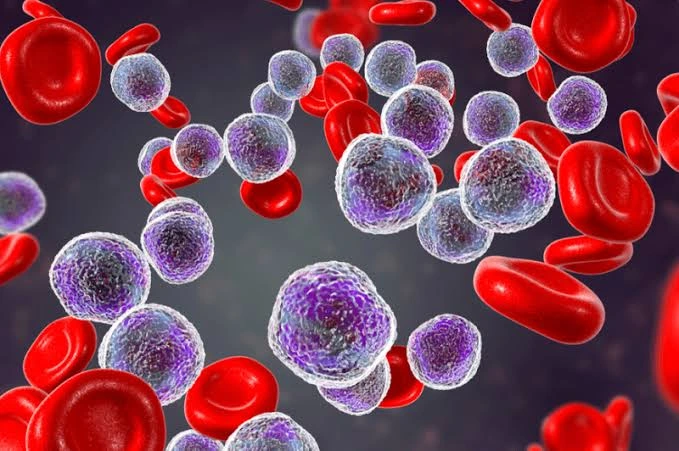 leucemia linfoide cronica liminar