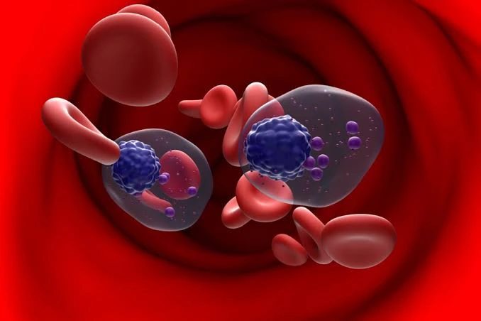 mieloma multiplo faq